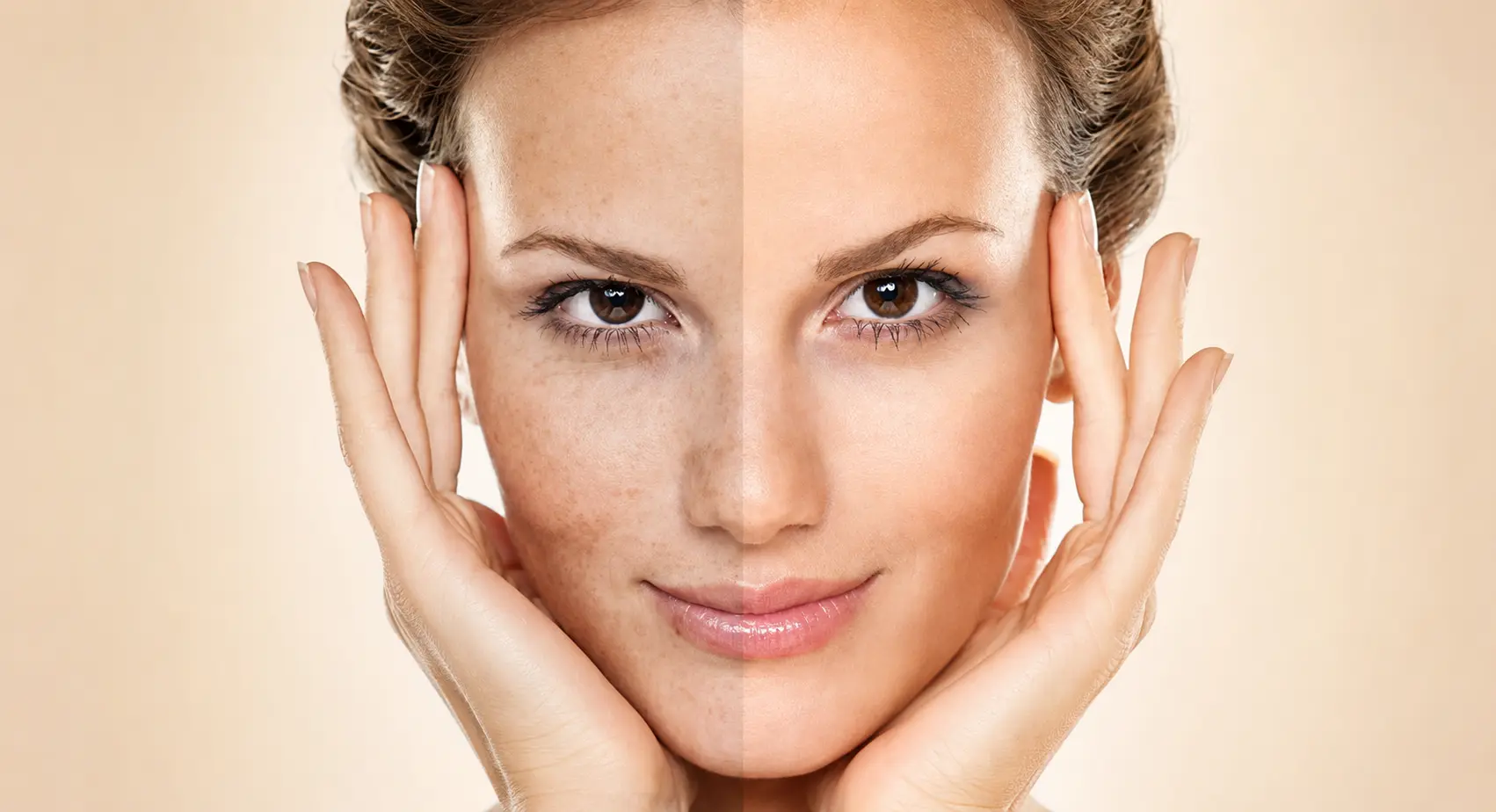 Split-face comparison illustrating visible sun damage and more even-looking skin